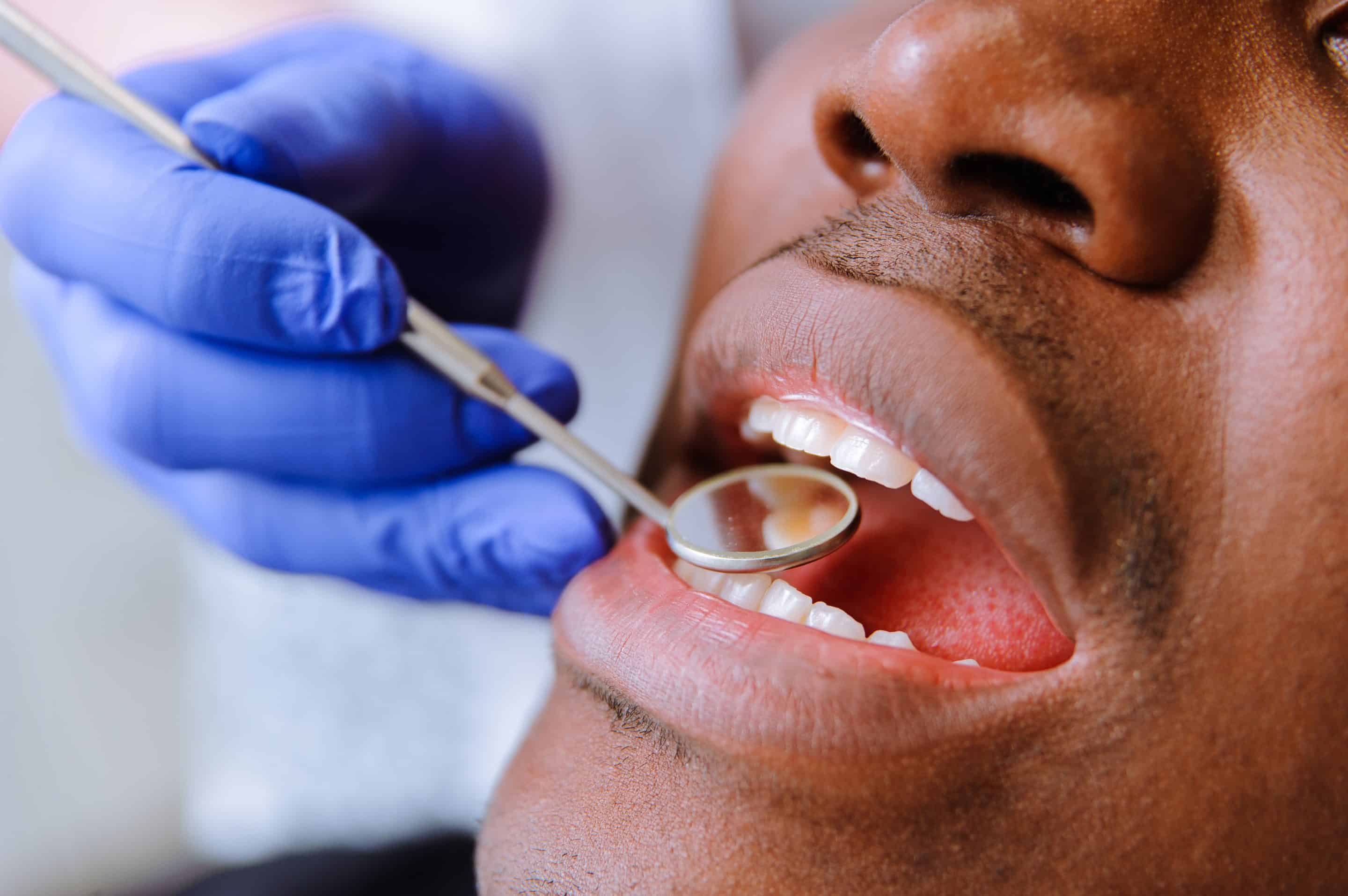 Dentist for Tooth Extractions in Bowling Green